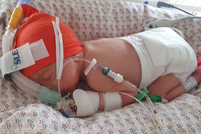 Triathlon challenge to raise money for exceptional unit